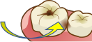 つめもの